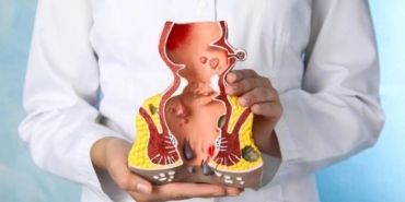 hemoroid-hakkinda-bilinmesi-gerekenler-vucudun-en-acil-imdat-sinyali-olabilir-vgbaqmMW.jpg