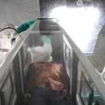 ebola-virusu-nedir-ebola-virusu-turkiyede-var-mi-dunyada-vaka-ve-olu-sayisi-kac-oldu-MzzNSC4z.jpg
